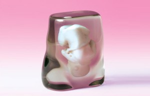 L&rsquo;impression 3D de votre foetus aujourd&rsquo;hui possible